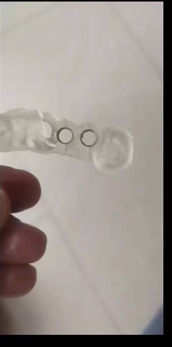 Resin Dental 3D Printer Planti - Glue For 3D Printing ulasan dan harga